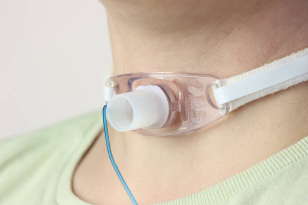 Tracheostomy Care